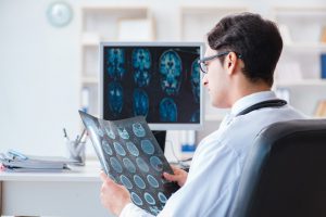 Radiology medical dictation, radiologist reviewing brain MRI scans with VoiceboxMD speech-to-text software